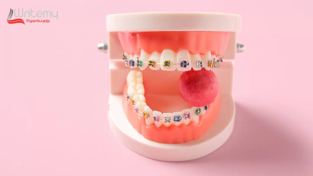 "Can you chew gum with braces? Model showing braces with gum stuck between teeth."